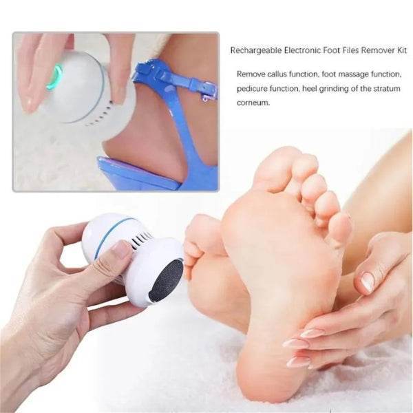 Electric Foot Callus Remover – Rechargeable Pedicure Tool - Gadget Spark